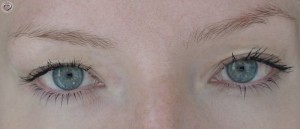 Concealer
