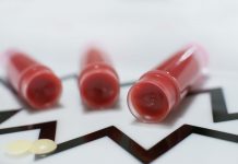 Naturkosmetik – Deos und Lippenpflege selber machen