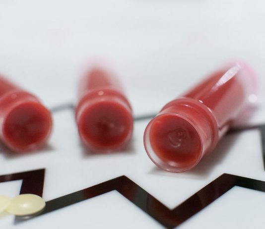 Naturkosmetik – Deos und Lippenpflege selber machen