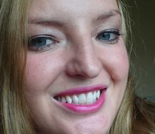 Endlich weiße Zähne – Meine zweite Bleaching Behandlung endlich-weisse-zaehne-meine-zweite-bleaching-behandlung-laecheln-mit-weissen-zaehnen