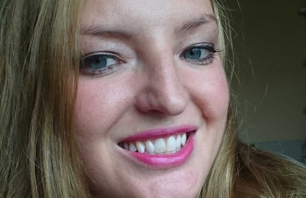 endlich-weisse-zaehne-meine-zweite-bleaching-behandlung-laecheln-mit-weissen-zaehnen