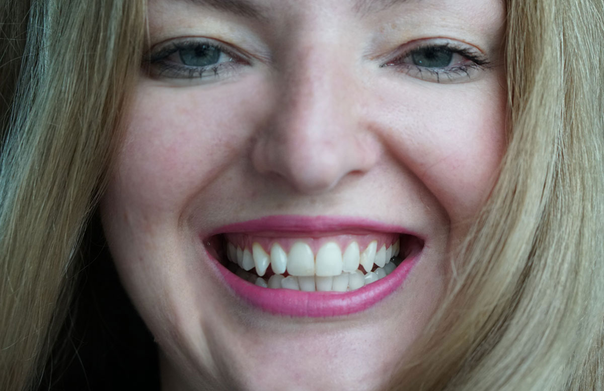 Erfahrungsbericht-Pure-Smile-Bar-in-Wien-laecheln