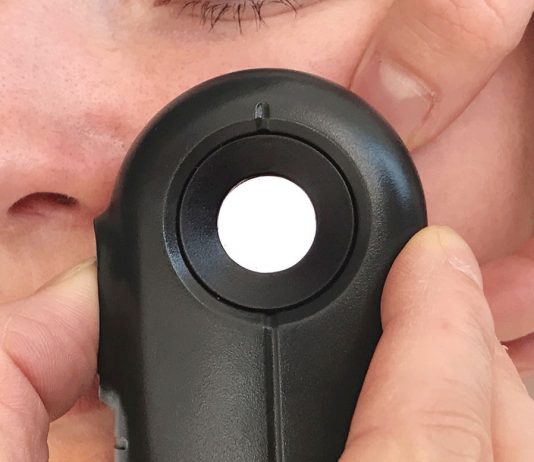 Muttermal Entfernung im Gesicht – Meine Erfahrung bei The Aesthetics Muttermal-Entfernung-im-Gesicht-Meine-Erfahrung-bei-The-Aesthetics-dermalight