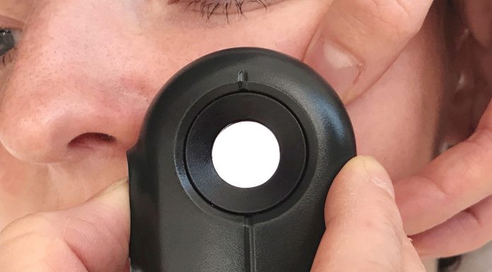 Muttermal Entfernung im Gesicht – Meine Erfahrung bei The Aesthetics Muttermal-Entfernung-im-Gesicht-Meine-Erfahrung-bei-The-Aesthetics-dermalight